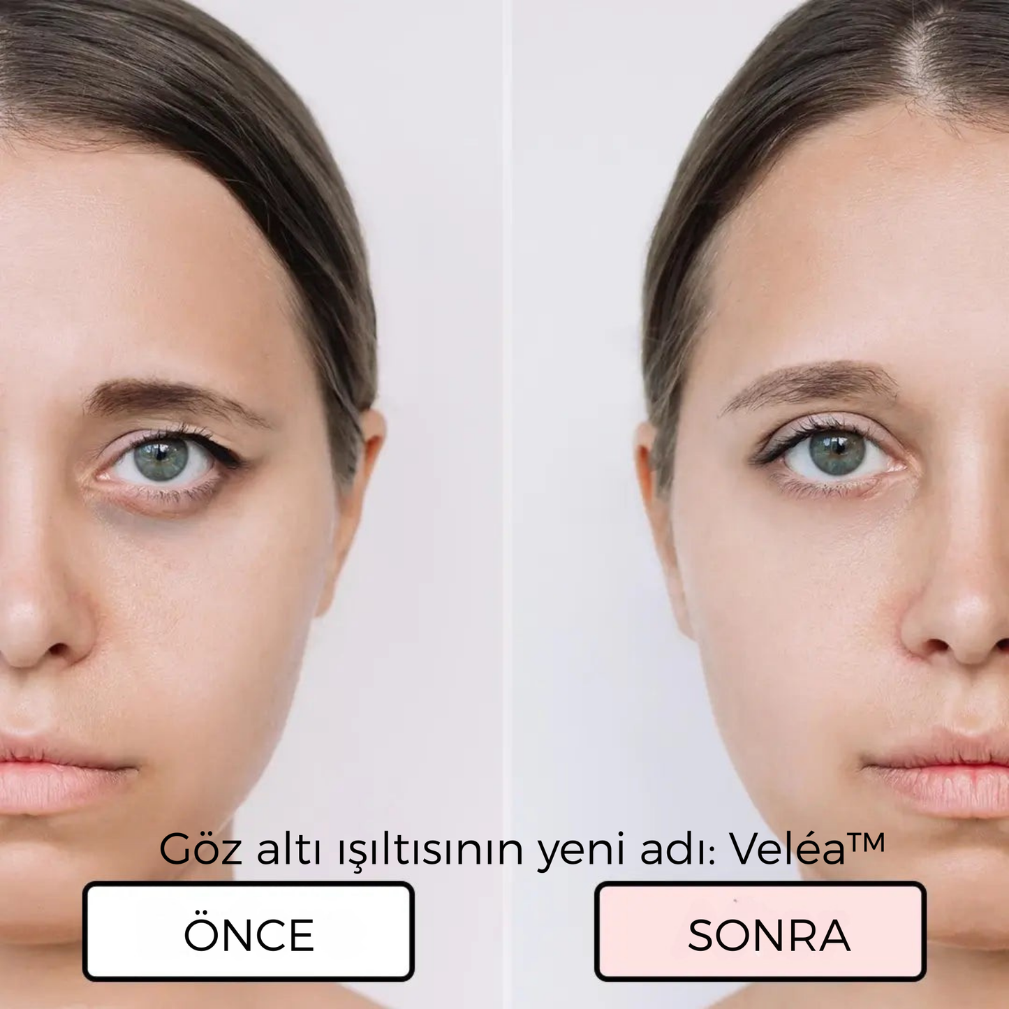 EyeLift – Göz Altı Yenileyici Teknoloji