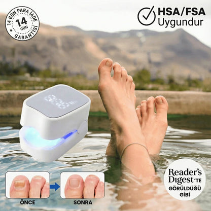 PureNail™ – Lazerli Tırnak Terapi Cihazı