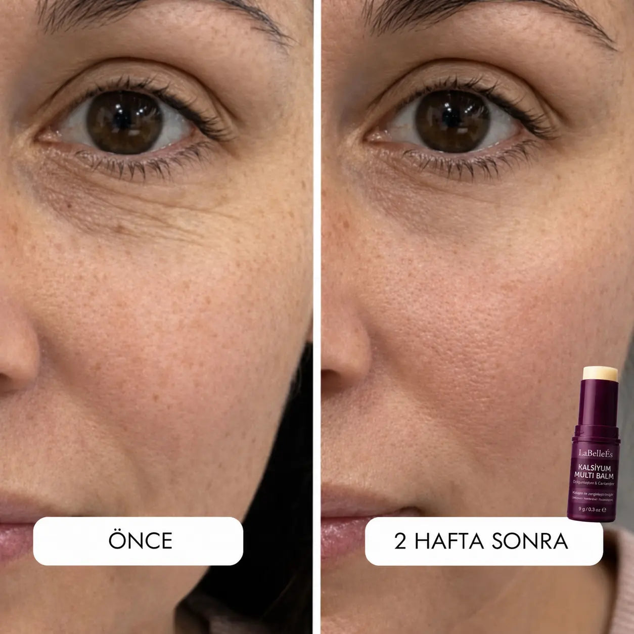 LaBelleÉs Dolgunlaştırıcı Balm Stick LaBelleÉs
