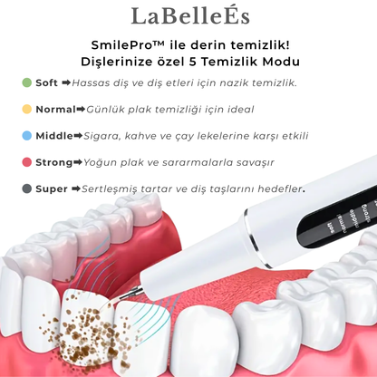 جهاز إزالة الجير بالموجات فوق الصوتية SmilePro™ من LaBelleÉs - جهاز عناية احترافي مزود بخمسة أوضاع إضاءة LED