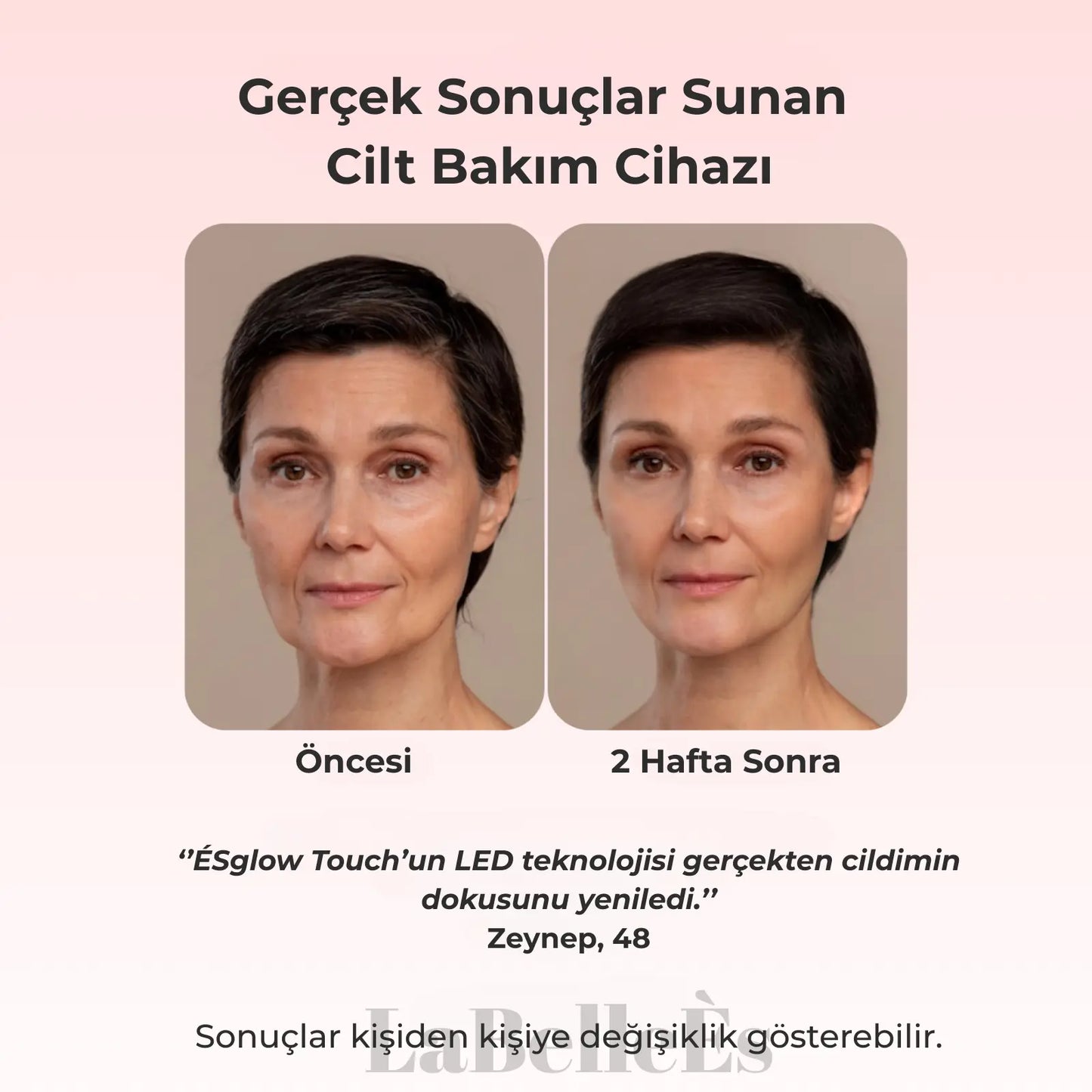 ÉSGLOW LED TERAPİSİ 7 IN 1 Mağazam