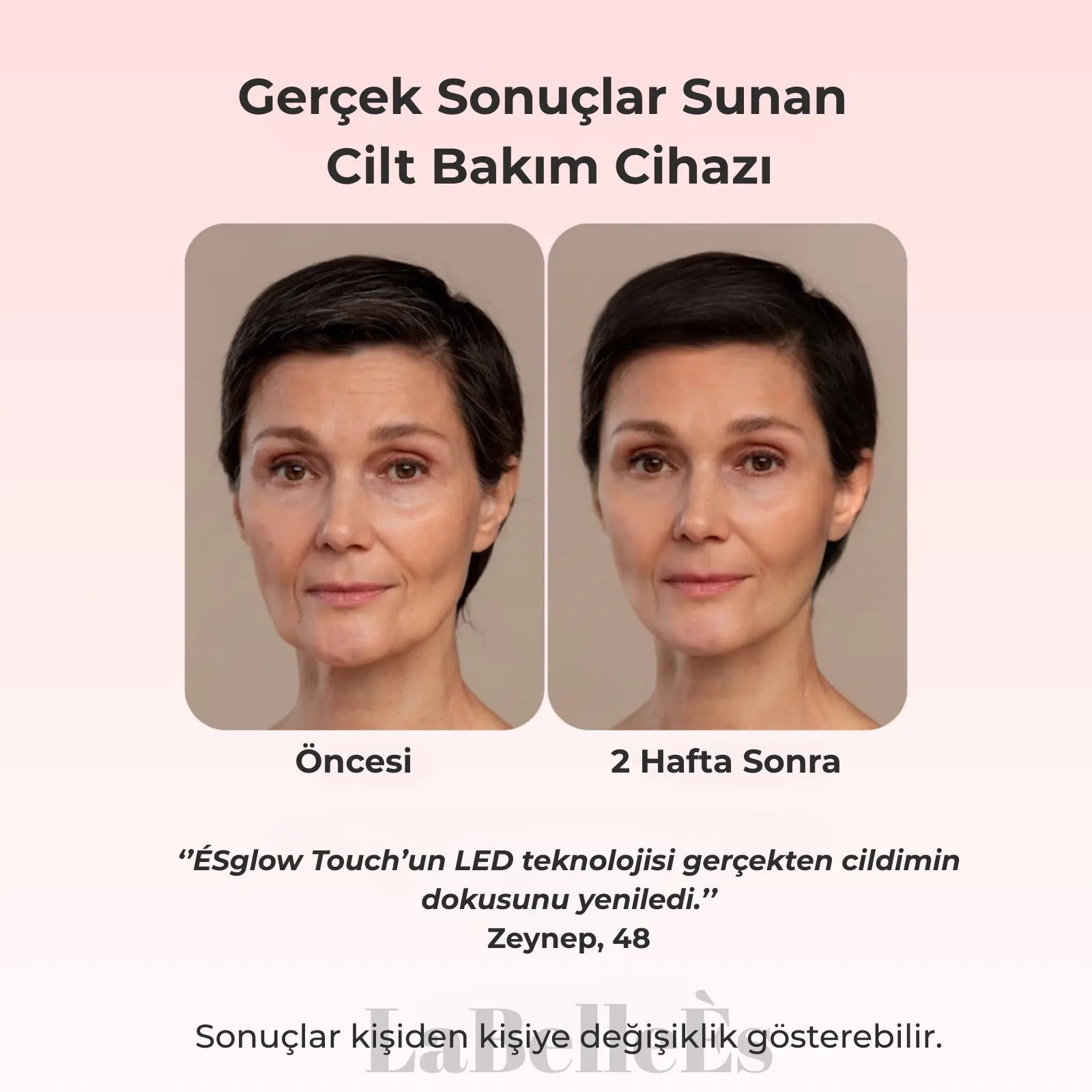 ÉSGLOW LED TERAPİSİ 7 IN 1 Mağazam